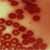 Erythrocytes, ground-squirrel's blood